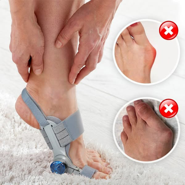Treatmedy Bunion Fix