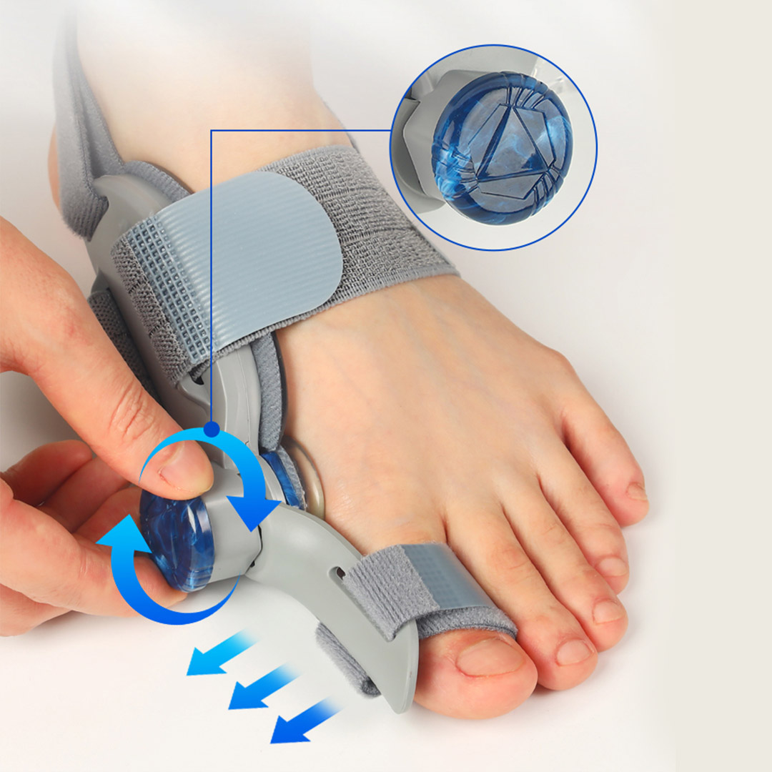 Treatmedy Bunion Fix Comparison