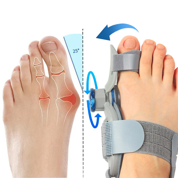 Treatmedy Bunion Fix Close-up